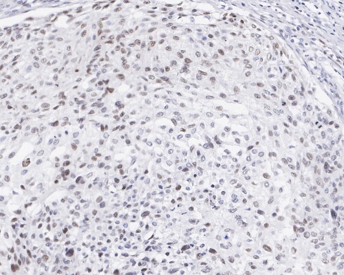 FRA1 Rabbit Monoclonal Antibody(ARA883)