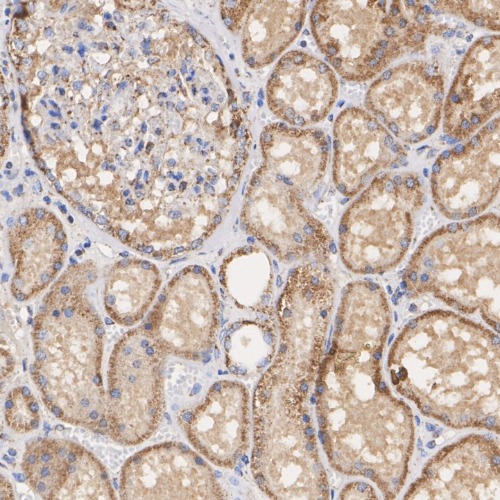 Fumarate hydratase Rabbit Monoclonal Antibody(ARA884)