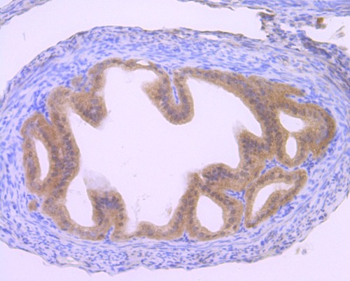 Gli1 Rabbit Monoclonal Antibody(ARA885)
