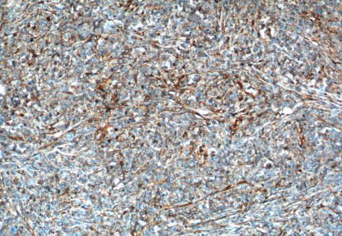 IFITM1 Mouse Monoclonal Antibody(ARA888)