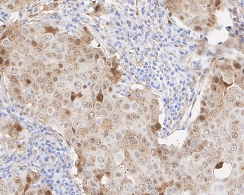 NOR-1 Rabbit Monoclonal Antibody(ARA890)