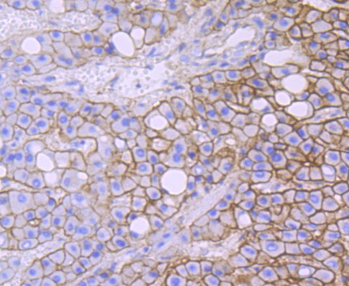 Spectrin Rabbit Monoclonal Antibody(ARA894)