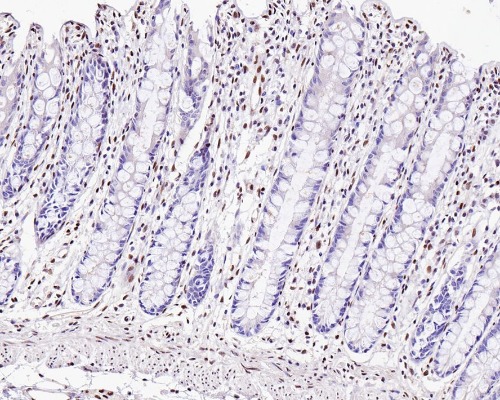 ZEB1 Rabbit Monoclonal Antibody(ARA895)