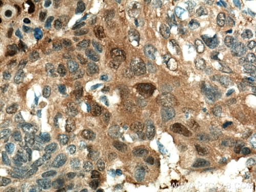 Maspin Mouse Monoclonal Antibody(ARA896)