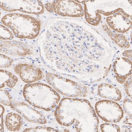 SDHA Rabbit Monoclonal Antibody(ARA900)