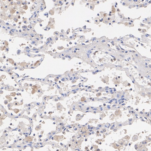DNP Rabbit Monoclonal Antibody(ARA904)