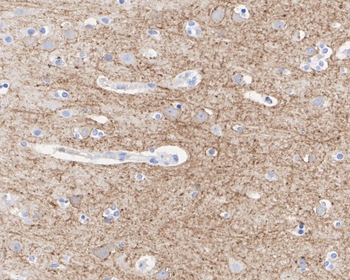 SSTR2 Rabbit Monoclonal Antibody(ARA911)