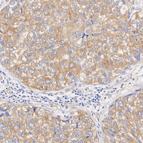 FGFR3 Rabbit Monoclonal Antibody(ARA915)