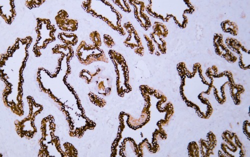PAP Mouse Monoclonal Antibody(ARA918)