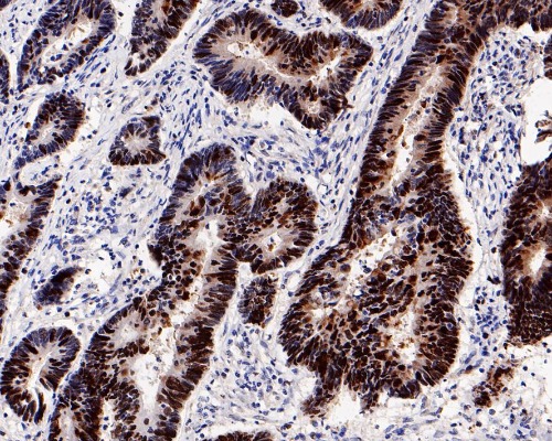Rb Rabbit Monoclonal Antibody(ARA919)