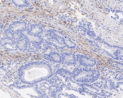 PDGFR&alpha; Rabbit Monoclonal Antibody(ARA921)