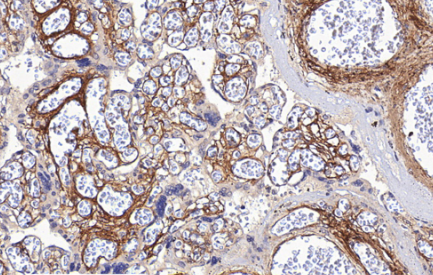 Collagen Type I Mouse Monoclonal Antibody(ARA924)
