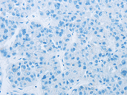 CYP11B1 Rabbit Polyclonal Antibody