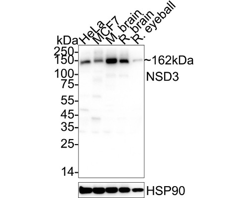NSD3 Rabbit Monoclonal Antibody(ARA928)