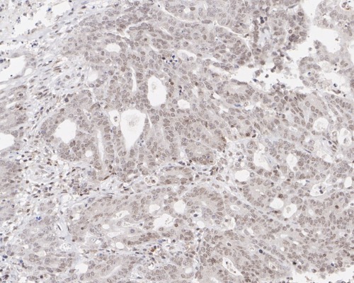 BRM Rabbit Monoclonal Antibody(ARA929)