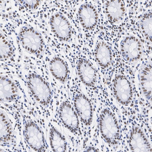 ARID1A Rabbit Monoclonal Antibody(ARA930)