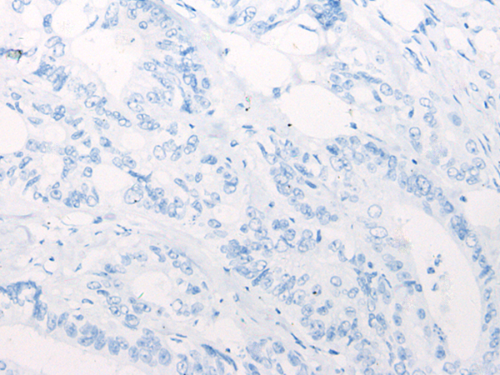 ARID1B Rabbit Polyclonal Antibody