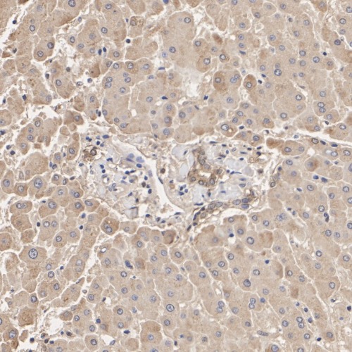 LXR alpha Rabbit Monoclonal Antibody(ARA934)