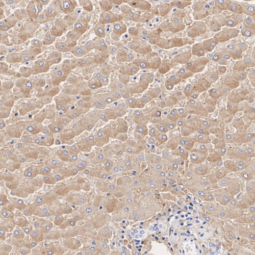 Human&nbsp;Serum&nbsp;Albumin&nbsp;Mouse&nbsp;Monoclonal&nbsp;Antibody(ARA935)