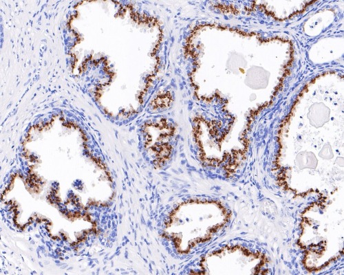 SLC45A3&nbsp;Rabbit&nbsp;Monoclonal&nbsp;Antibody(ARA937)