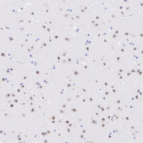 MEF2C Rabbit Monoclonal Antibody(ARA940)