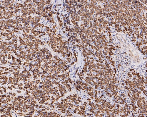 BCL-2 Rabbit Monoclonal Antibody(ARA941)