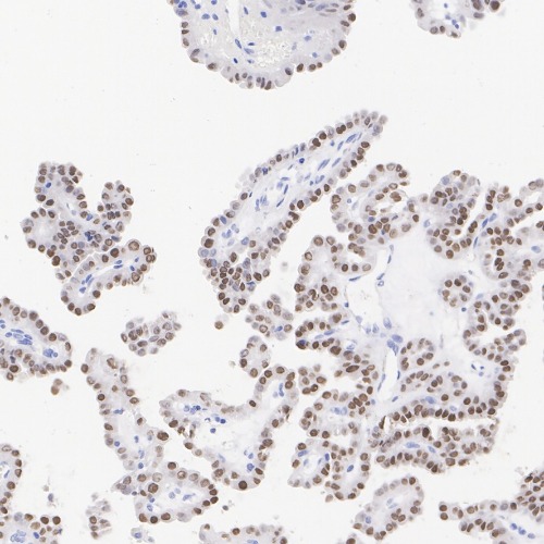 TTF1 Rabbit Monoclonal Antibody(ARA942)