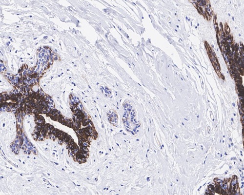 Cytokeratin 5&6 Rabbit Monoclonal Antibody(ARA943)
