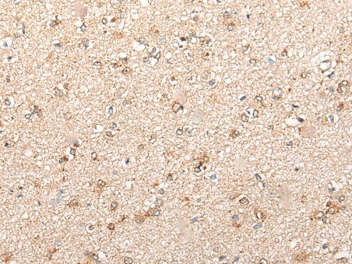 CYP11B2 Rabbit Polyclonal Antibody
