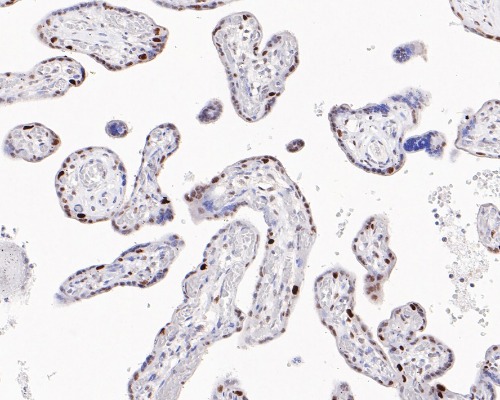 Cyclin E1 Rabbit Monoclonal Antibody(ARA952)