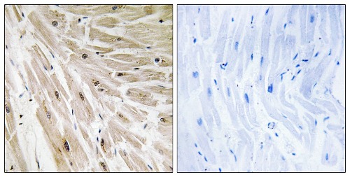 EBER/Ribosomal Protein L22 Rabbit Polyclonal Antibody