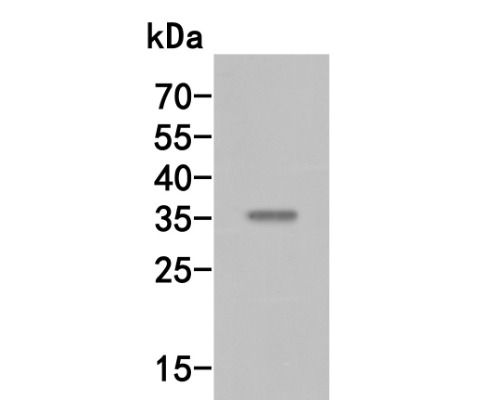 MEOX2 Rabbit Polyclonal Antibody