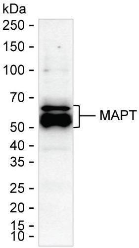 Tau (S422) Mouse Monoclonal Antibody(ARA958)