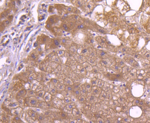 TAPA1/CD81 Rabbit Monoclonal Antibody(ARA961)