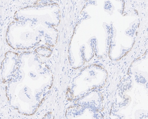 TRIM29 Rabbit Monoclonal Antibody(ARA963)
