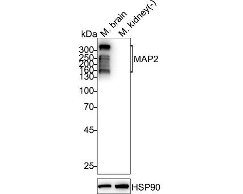 MAP2 Rabbit Monoclonal Antibody(ARA965)