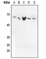 SMAD2/3 (Phospho-T8)  Rabbit Polyclonal Antibody