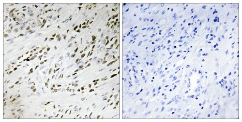 TSHZ2 Rabbit Polyclonal Antibody