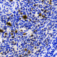 POU2F3 Rabbit Polyclonal Antibody