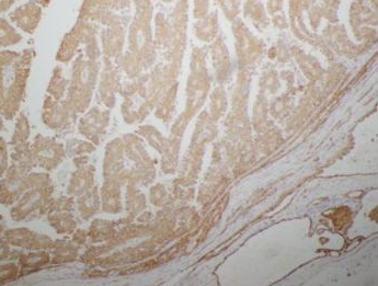 2SC Rabbit Polyclonal Antibody