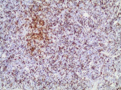 TCR beta F1 Mouse Monoclonal Antibody(ARA986)