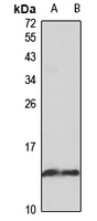 PLA2G1B Rabbit Polyclonal Antibody