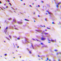 CDYL2 Rabbit Polyclonal Antibody