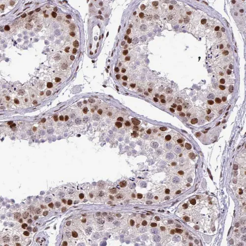 CDYL Rabbit Polyclonal Antibody