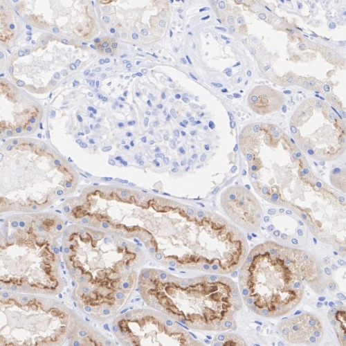 FOLR1 Rabbit Monoclonal Antibody(ARA992)