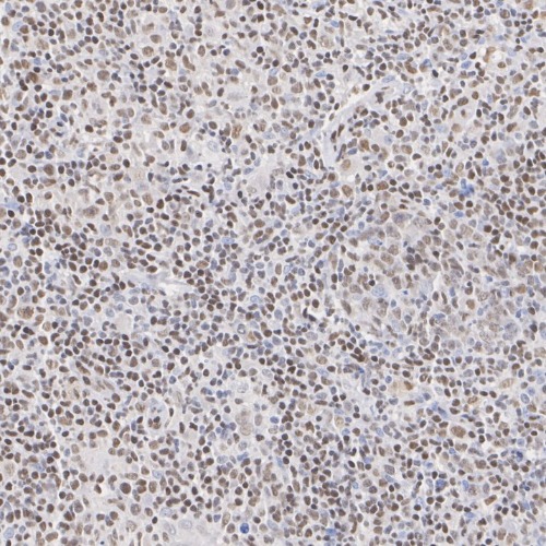 FLI1 Rabbit Monoclonal Antibody(ARA995)