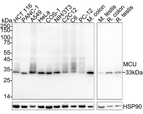 MCU Mouse Monoclonal Antibody(ARA997)